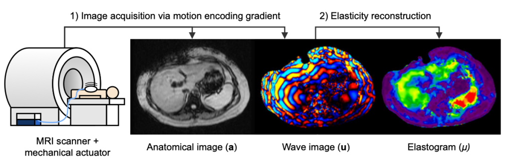 AI-powered interpretable imaging phenotypes noninvasively